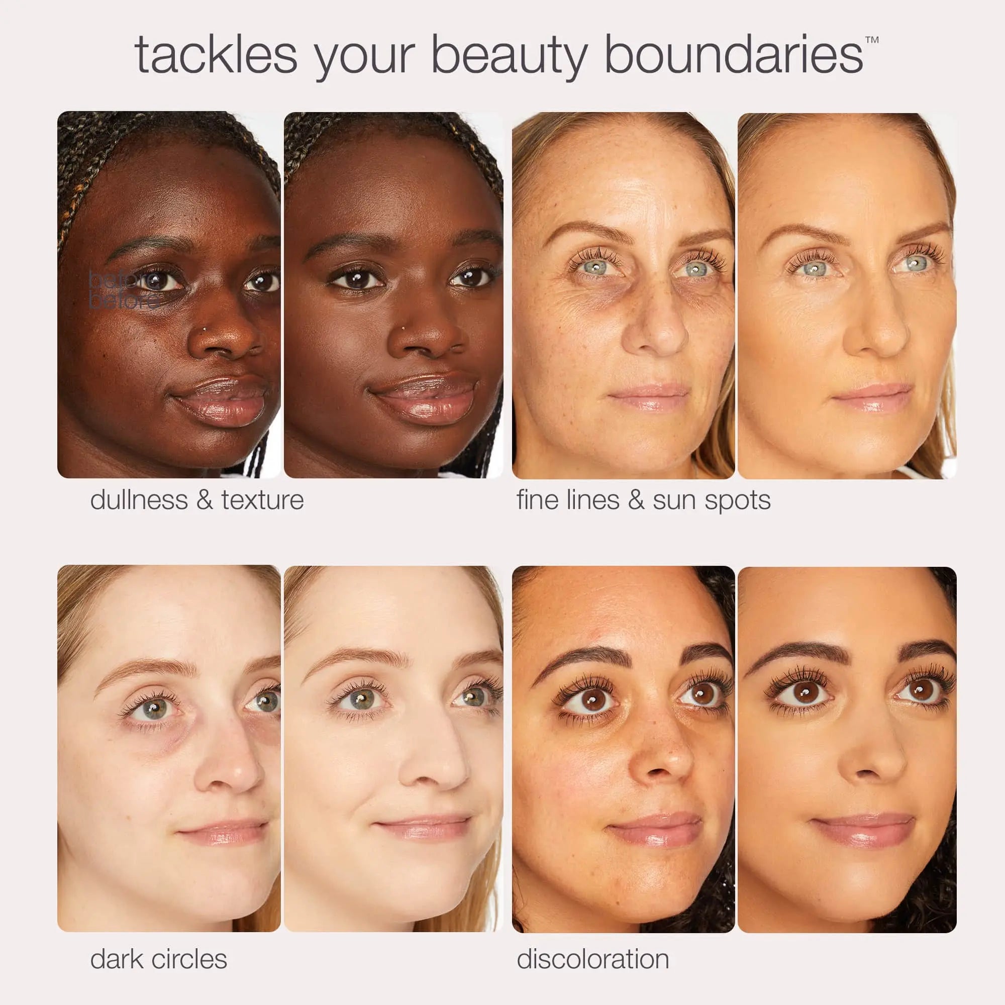 Tarte BB Blur Tinted Moisturizer SPF 30 - Instantly Brightens, Hydrates & Smooths Your Skin